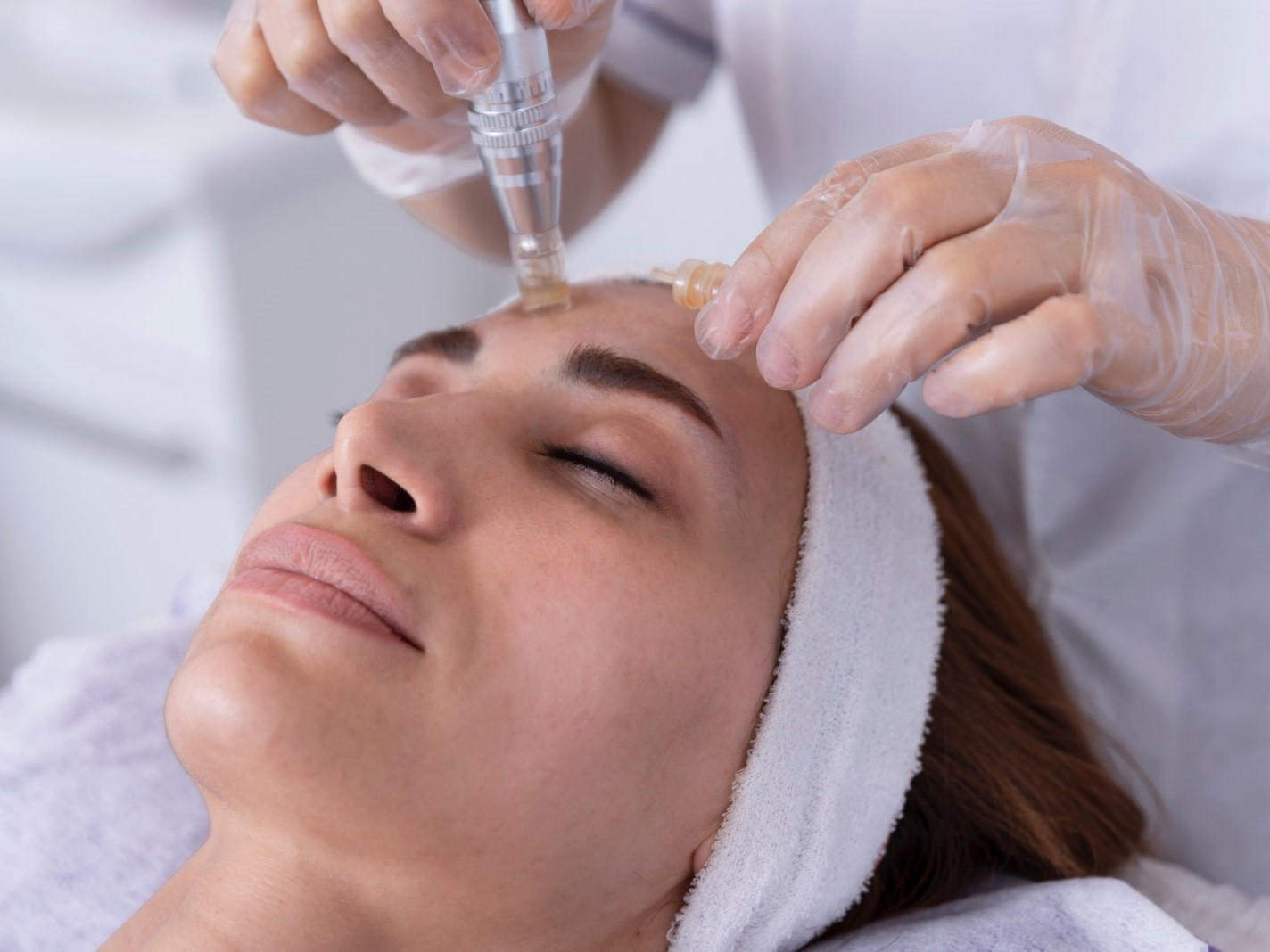 Microneedling cu PRP / GFC